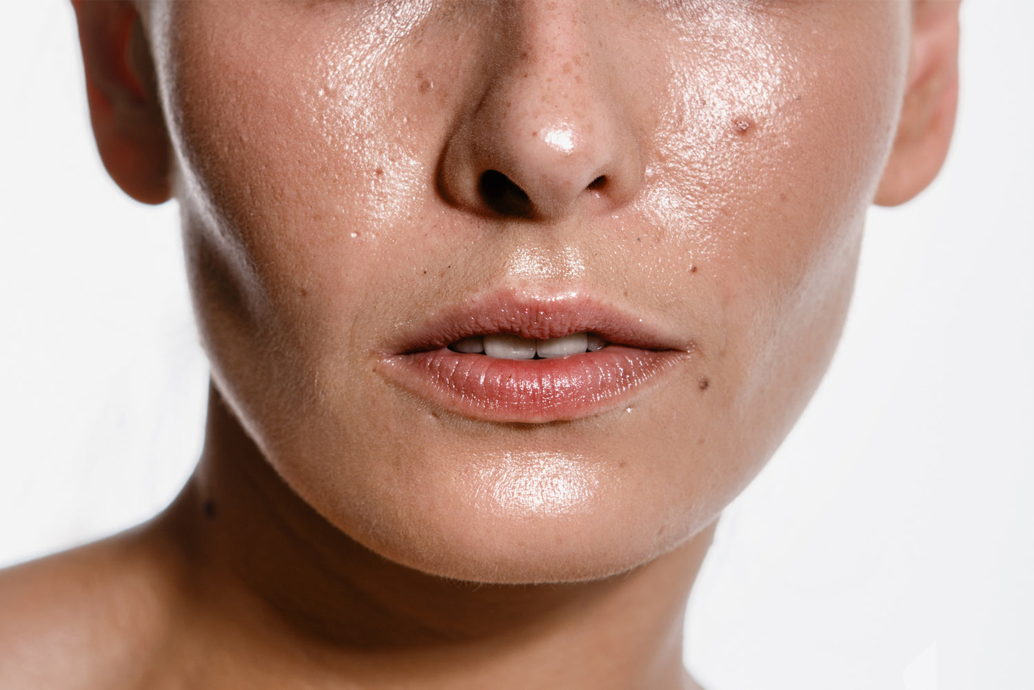 Problemi Dermatologici